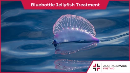Bluebottle jellyfish floating on the sea