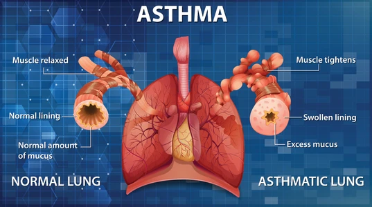 Lung showing normal and asthmatic lung